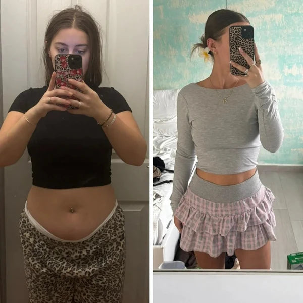 Parches GLP-1 de berberina 3 en 1 - Reduce hasta 8kg en 90 días sin pastillas.